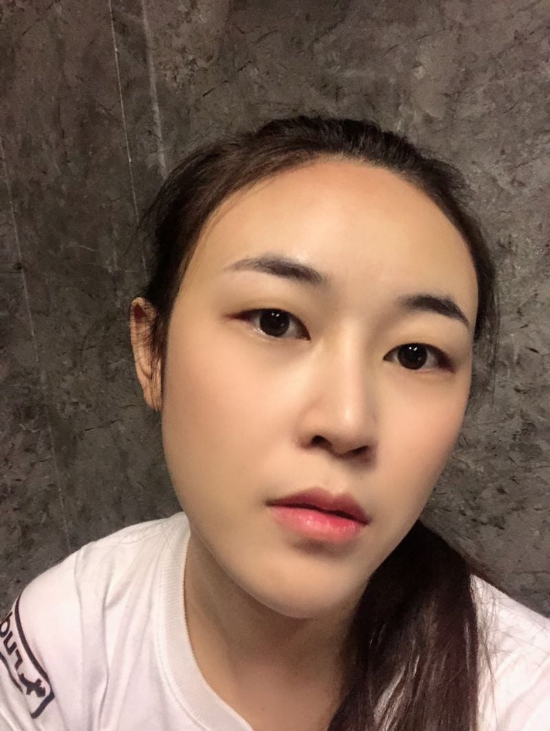 ทําตาสองชั้น เปิดหัวตา