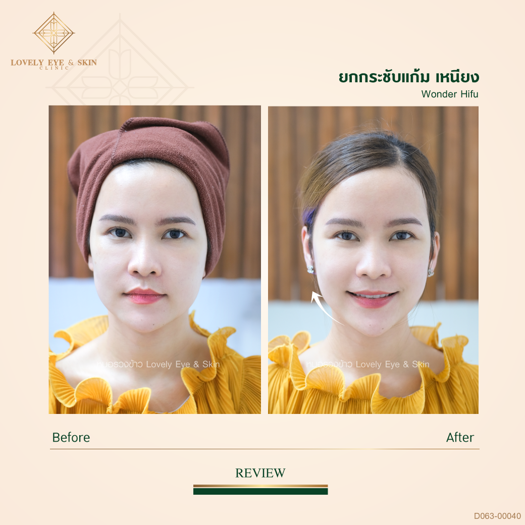 010-Hifu-พี่โบว์-Y063_00040.png