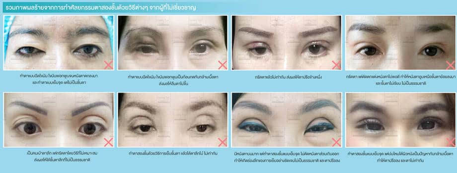 ทำตาสองชั้น เปิดหัวตา