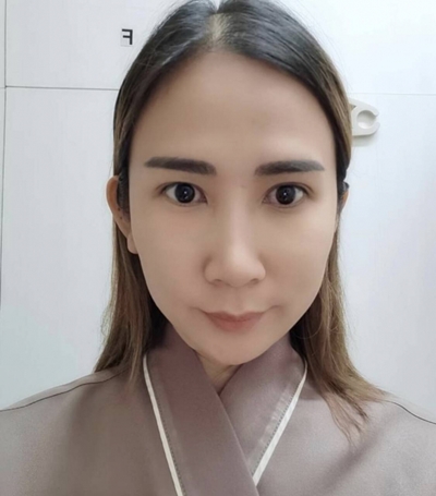 ทำตาสองชั้น เปิดหัวตา