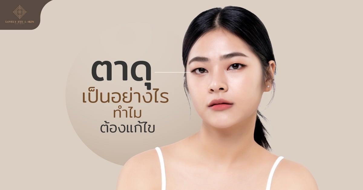 ตาดุเป็นอย่างไร ทำไมต้องแก้ไข คนตาดุ จะมีตาเล็ก ตาชั้นเดียว ทำให้หน้าดุ ดูโกรธ ดูเหวี่ยง