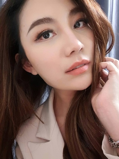 หลังตัดถุงใต้ตา 1 เดือน