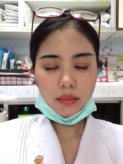 ทำตาสองชั้น เปิดหัวตา