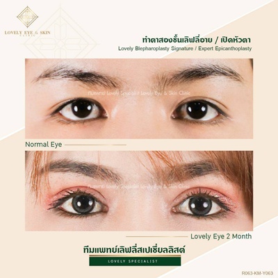 ทำตาสองชั้น