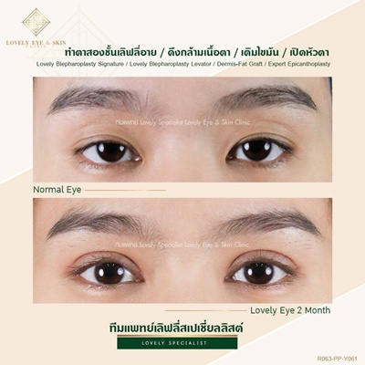 ทำตาสองชั้น