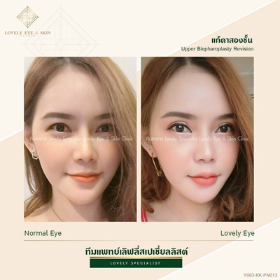 ทำตาสองชั้น