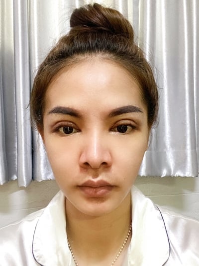 ทำตาสองชั้น เปิดหัวตา