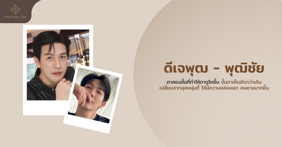 ดีเจพุฒ พุฒิชัย เคยทำศัลยกรรมตามาแล้ว เดิมที่มีตาชั้นเดียว ทำให้ตาดูโตขึ้น ชั้นตาเห็นชัด