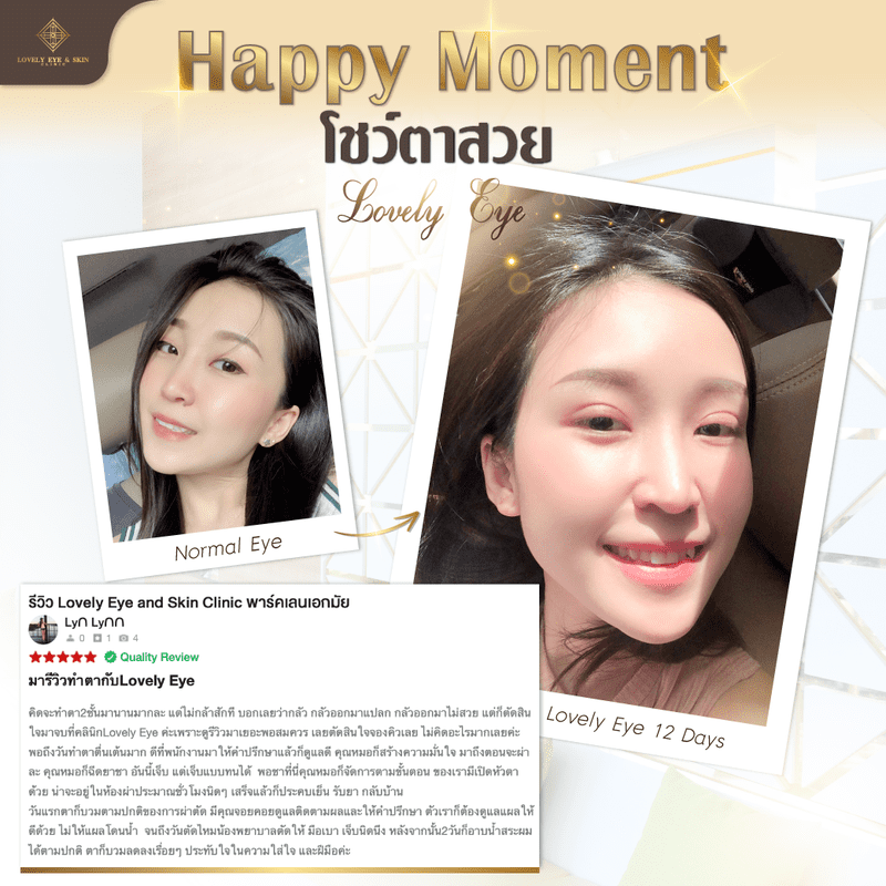ทำตาสองชั้น เปิดหัวตา