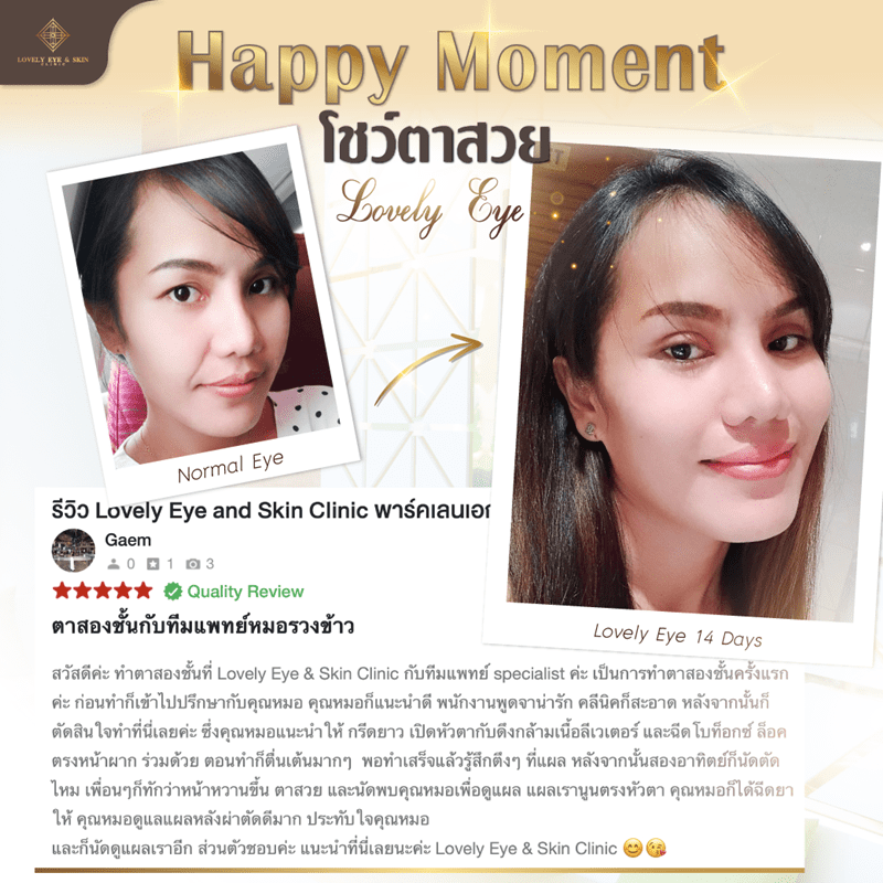 ทำตาสองชั้น เปิดหัวตา ดึงกล้ามเนื้อตา