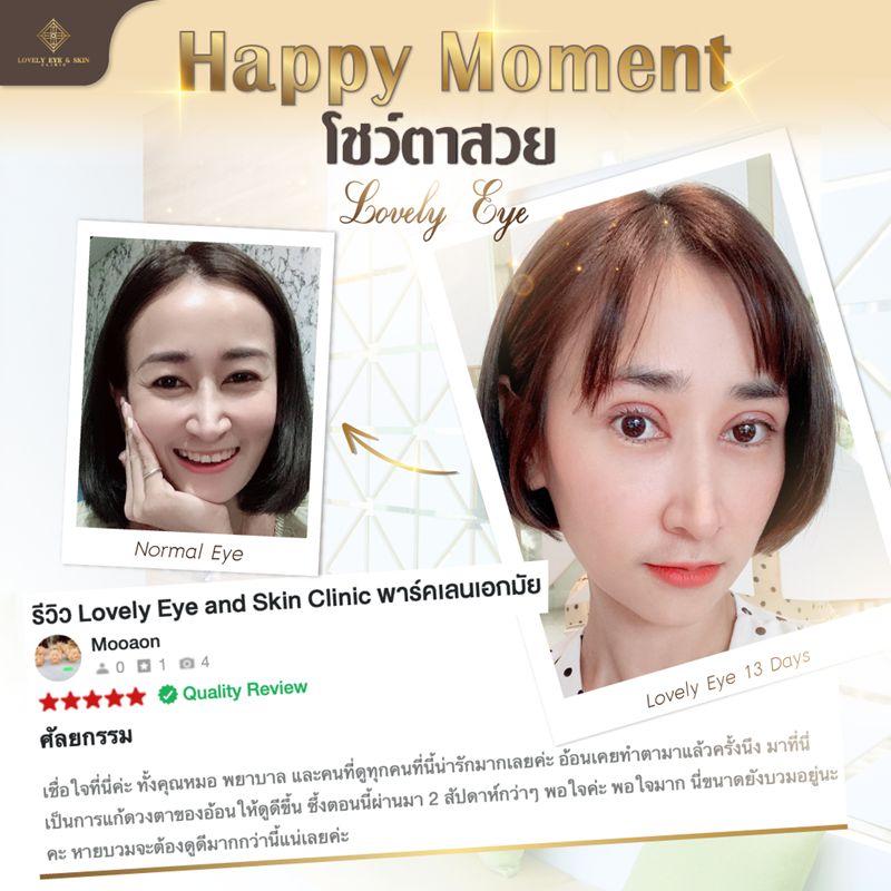 แก้ตาสองชั้น เปิดหัวตา ยกใต้คิ้ว