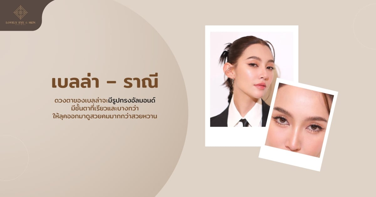 ตาเบลล่า นางเอกตาสวย เบลล่า ราณี มีรูปทรงอัลมอนด์คล้ายแอน ทองประสม