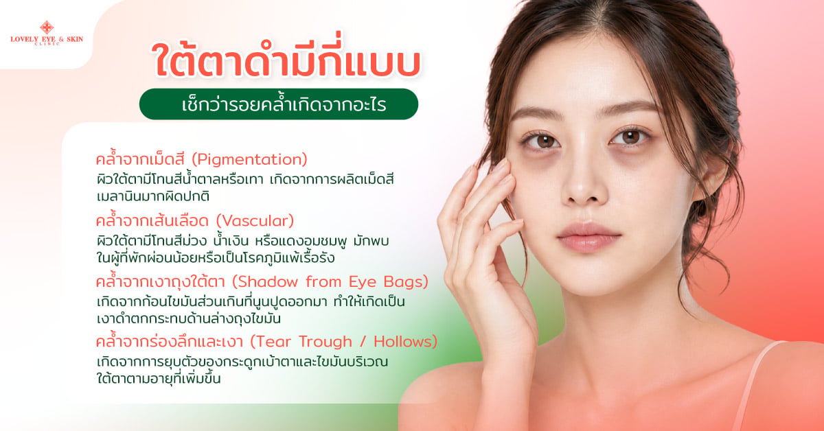 ใต้ตาดำมีกี่แบบ เช็กว่ารอยคล้ำเกิดจากอะไร