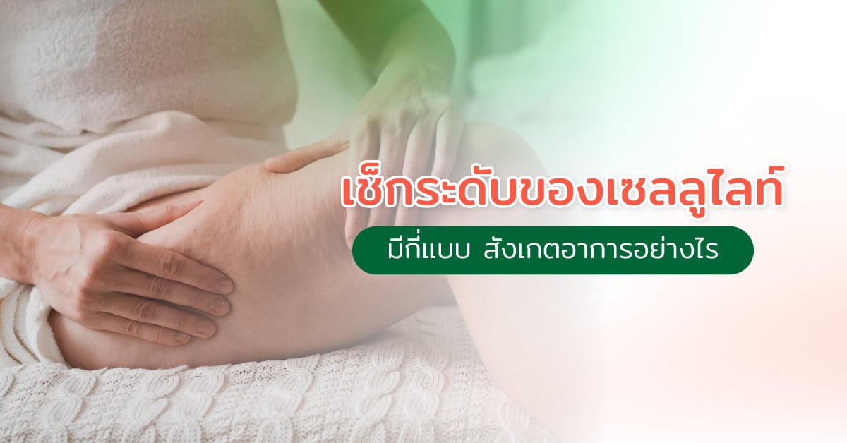 เช็กระดับของเซลลูไลท์มีกี่แบบ สังเกตอาการอย่างไร