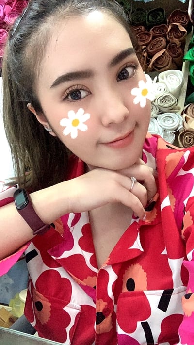 หลังทำตาสองชั้น 24 วัน ตาดูโต สดใสขึ้น