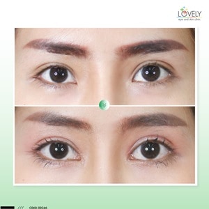 4.2 เทคนิคการเปิดหัวตา.jpg