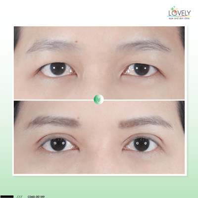 5 หางตาจะยกขึ้น C0189 สุธาสินี เมทนีดล 2 ชั้น+เปิดหัว หมอรวงข้า_1.png