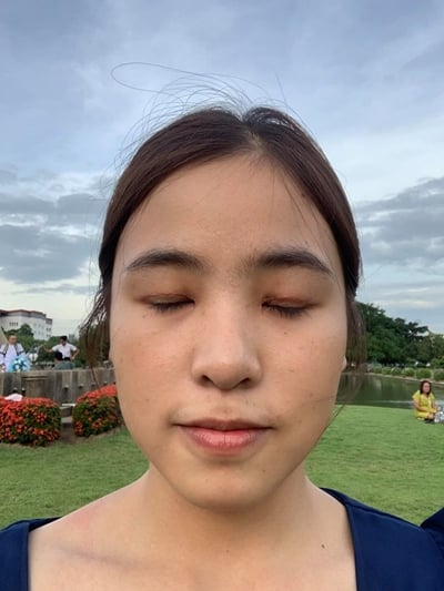 ทำตาสองชั้น เปิดหัวตา