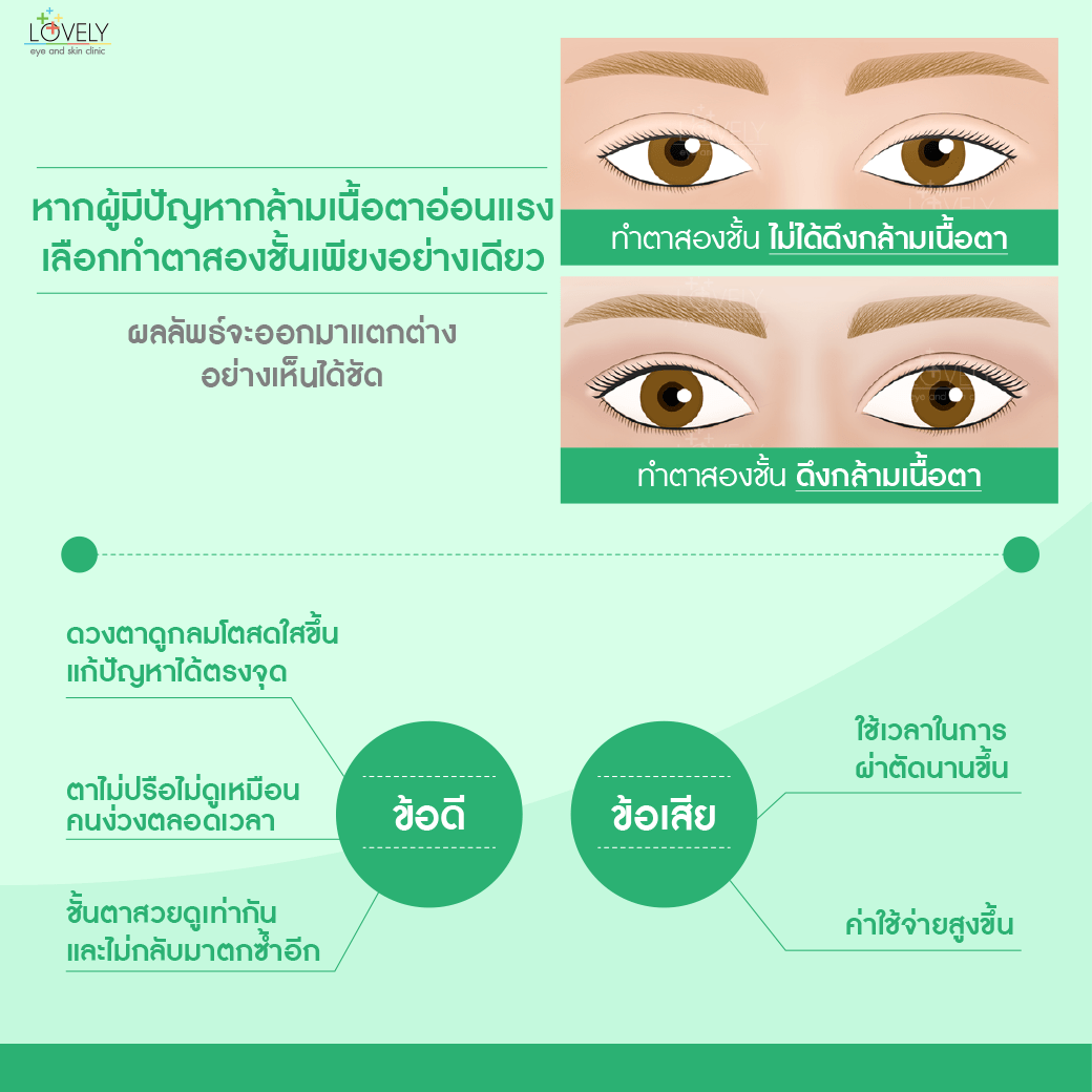7 เปิดกล้ามเนื้อตา.png