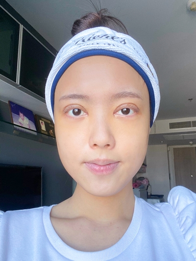 ทำตาสองชั้น เปิดหัวตา หนังตาตก