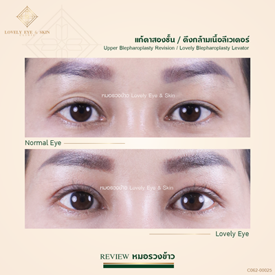 ทำตาสองชั้น