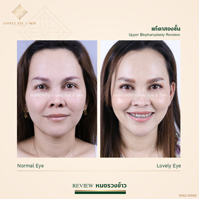 ทำตาสองชั้น