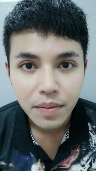 แก้ตาสองชั้น + เปิดหัวตา 