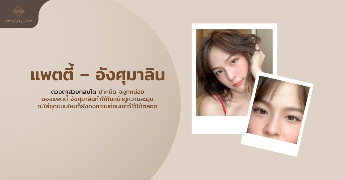 นางเอกสาวหน้าเด็กตลอดกาล แพตตี้ อังศุมาลิน ดูอ่อนวัยอยู่ตลอด ด้วยดวงตาสวยกลมโต