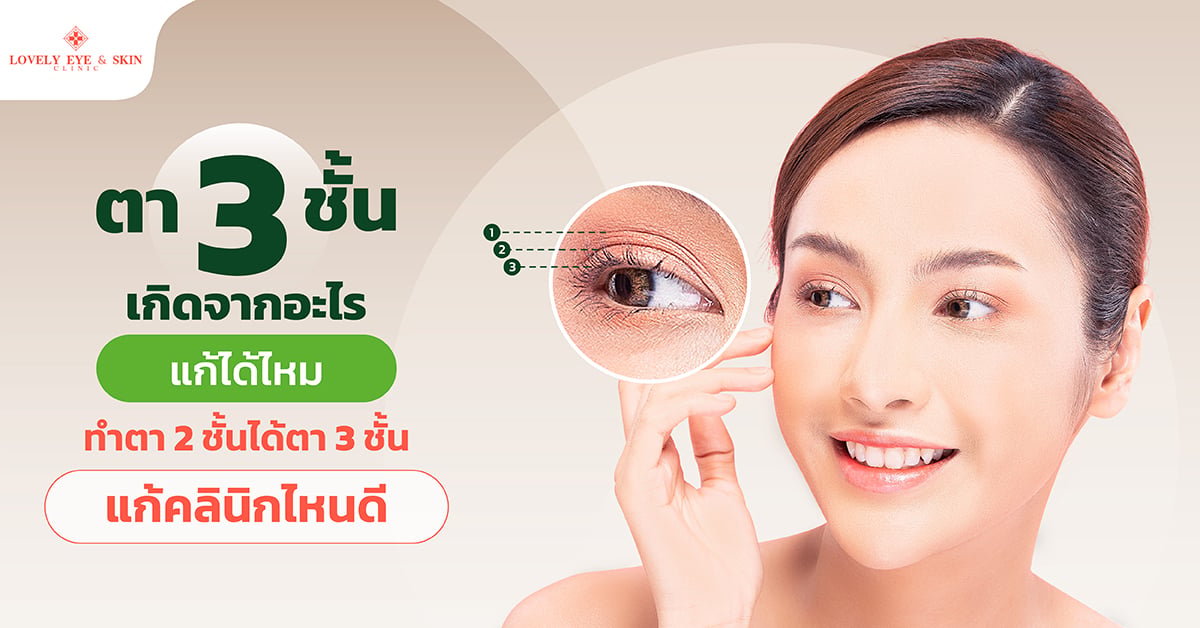 ตามสามชั้นเกิดจากอะไร Lovely Eye Clinic