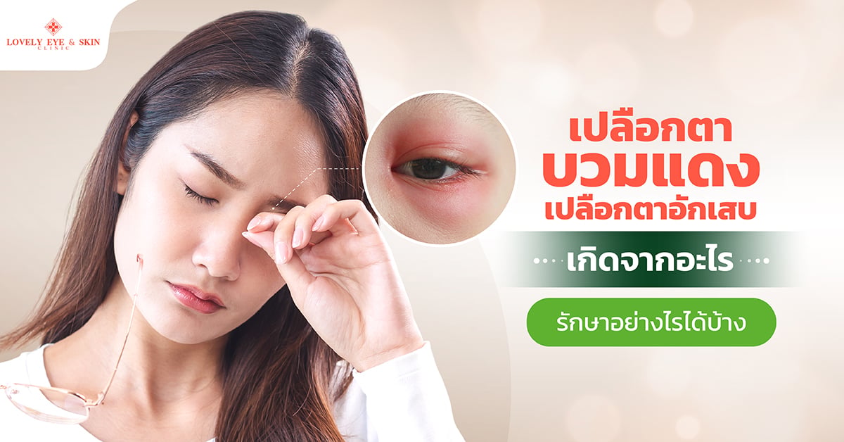 ปลือกตาบวมแดง
