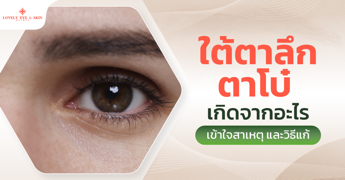 ใต้ตาลึก