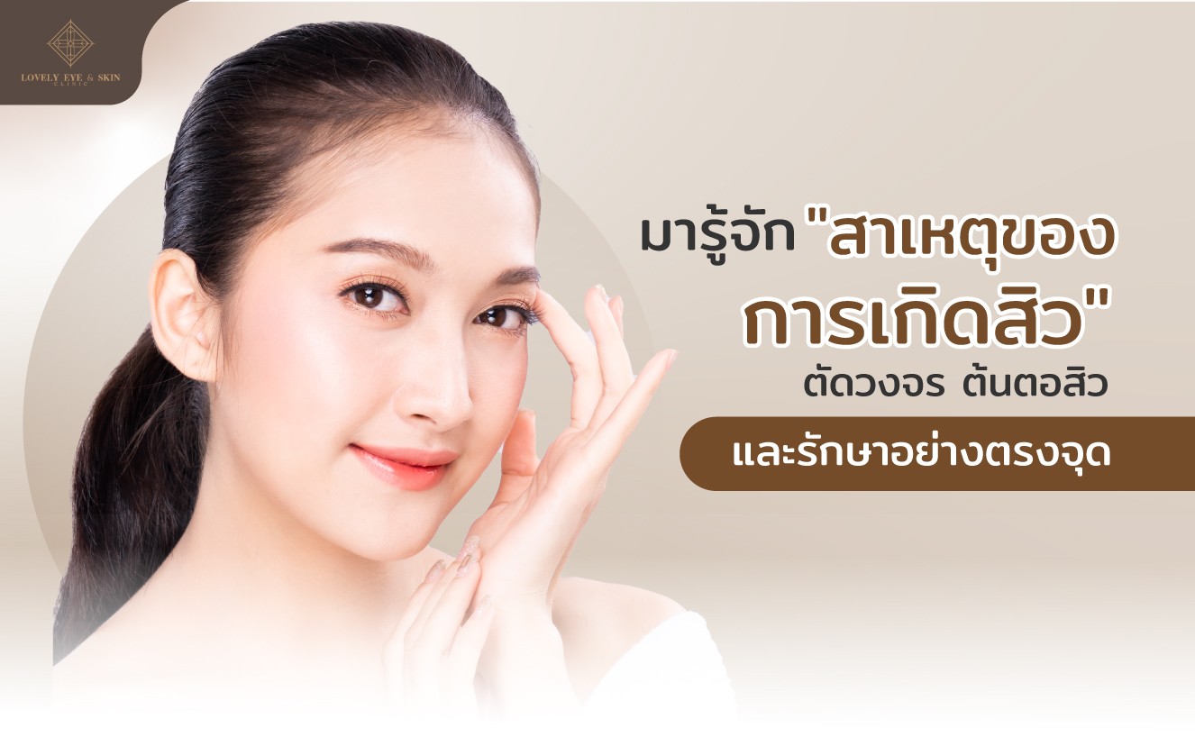 เรียนรู้เกี่ยวกับสิว เพื่อรู้สาเหตุที่แท้จริงของการเกิดสิว ตลอดจนการป้องกัน และวิธีรักษาสิวอ