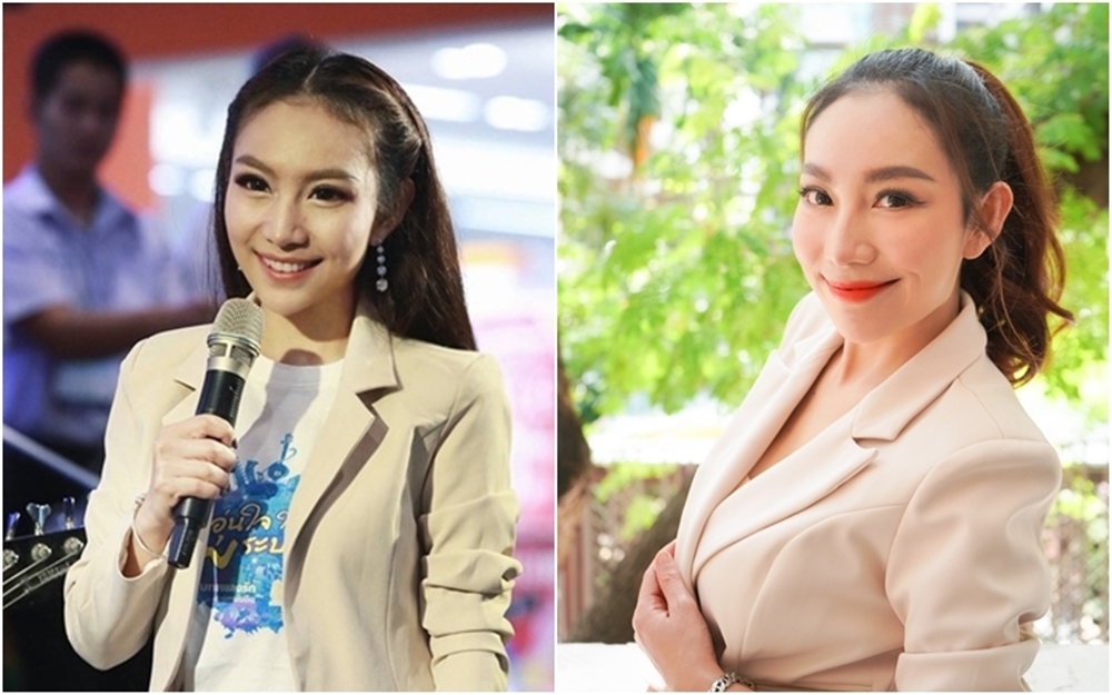 ตัดถุงใต้ตา