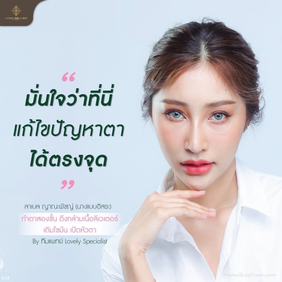Brief-สื่อ-PR-(รวมเคสสวยหล่อ)-แยก7_0.jpg