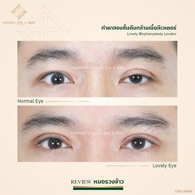 ทำตาสองชั้น ทำตาสองชั้นผู้ชาย