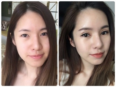 แก้ตาสองชั้น เปิดหัวตา