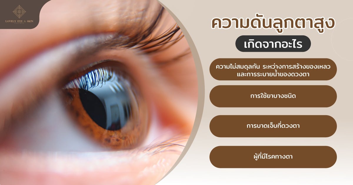 ความดันลูกตาสูง เกิดจาก ความไม่สมดุลของเหลวในตา การใช้ยาบางชนิด การบาดเจ็บ หรือมีโรคตา