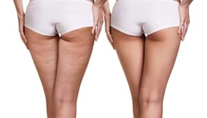 Fotolia_129890556_M-700x400.jpg