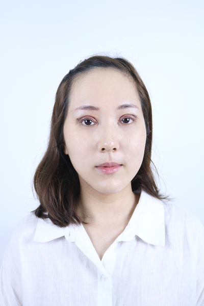 ทำตาสองชั้น+เปิดหัวตาทันที ชั้นตาชัดเจนมาก
