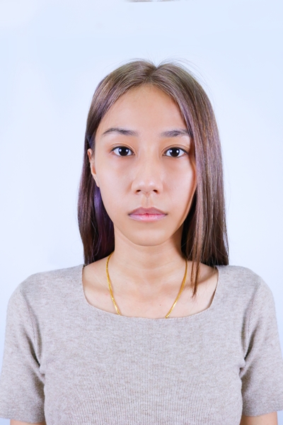 แก้ตาสองชั้น หมอรวงข้าว