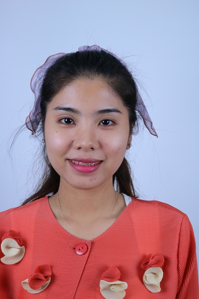 ทำตาสองชั้น เปิดหัวตา