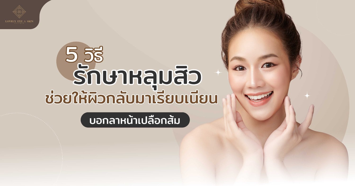 5 วิธีรักษาหลุมสิว ให้ผิวเรียบเนียน หลุมสิวมีหลายประเภท และมีความรุนแรงที่แตกต่างกัน