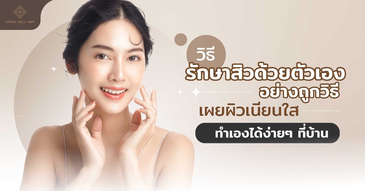 วิธีรักษาสิวด้วยตนเอง
