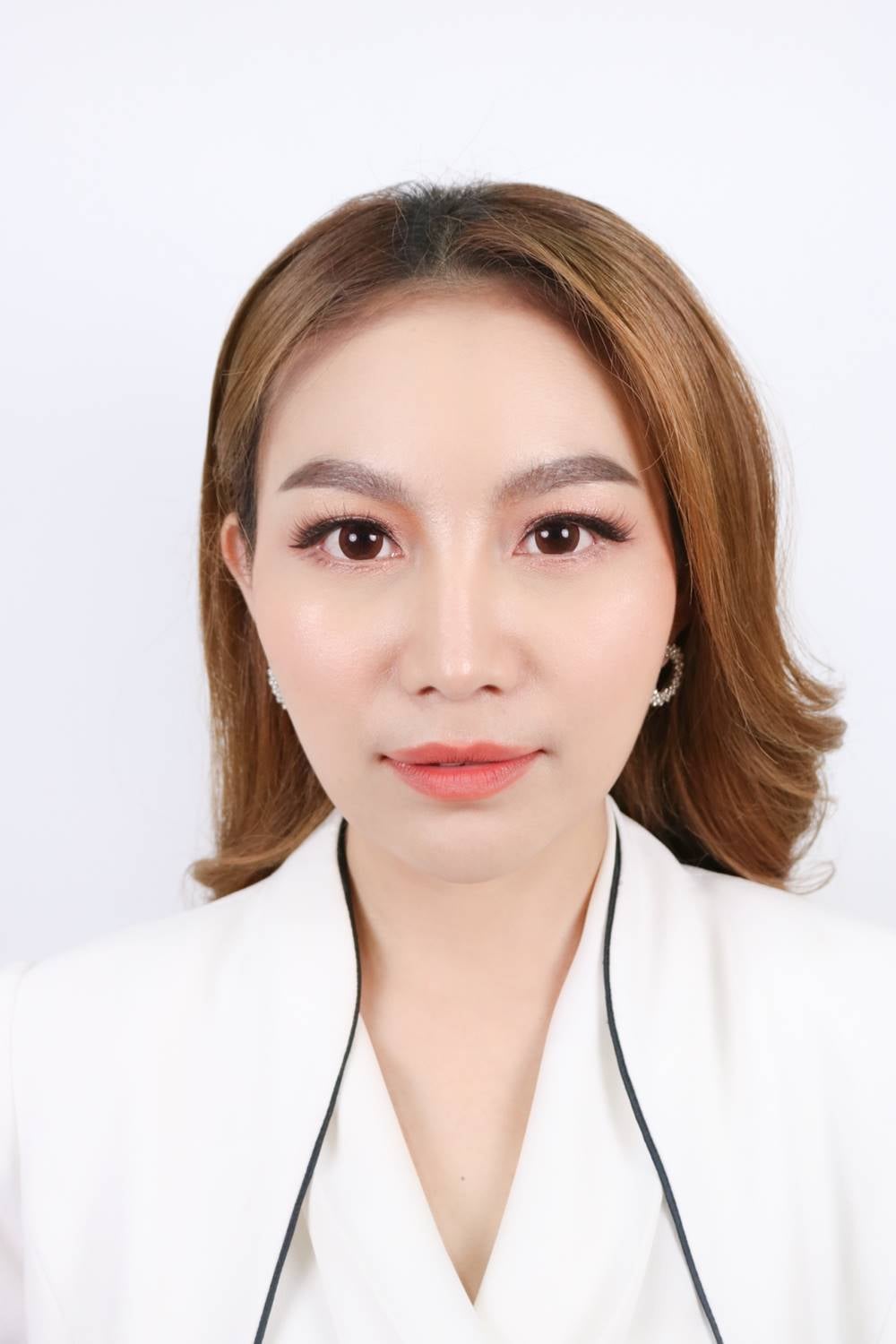 หลังตัดถุงใต้ตา 6 เดือน