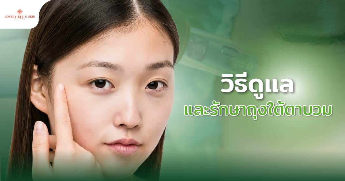 วิธีดูแลและรักษาถุงใต้ตาบวม