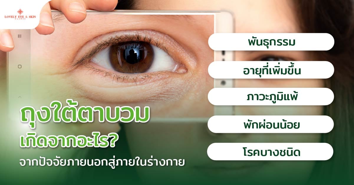 ถุงใต้ตาบวมเกิดจากอะไร? จากปัจจัยภายนอกสู่ภายในร่างกาย 