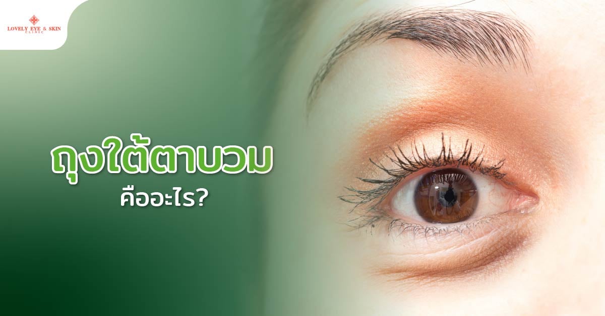 ถุงใต้ตาบวมคืออะไร?