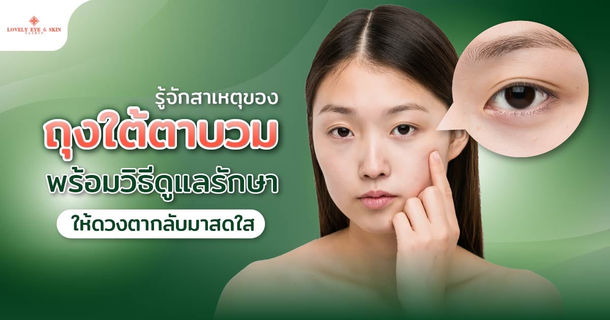 รู้จักสาเหตุของถุงใต้ตาบวม พร้อมวิธีดูแลรักษาให้ดวงตากลับมาสดใส