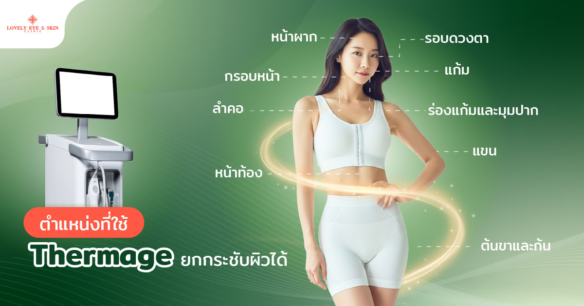 ตำแหน่งที่ใช้ Thermage ยกกระชับผิวได้