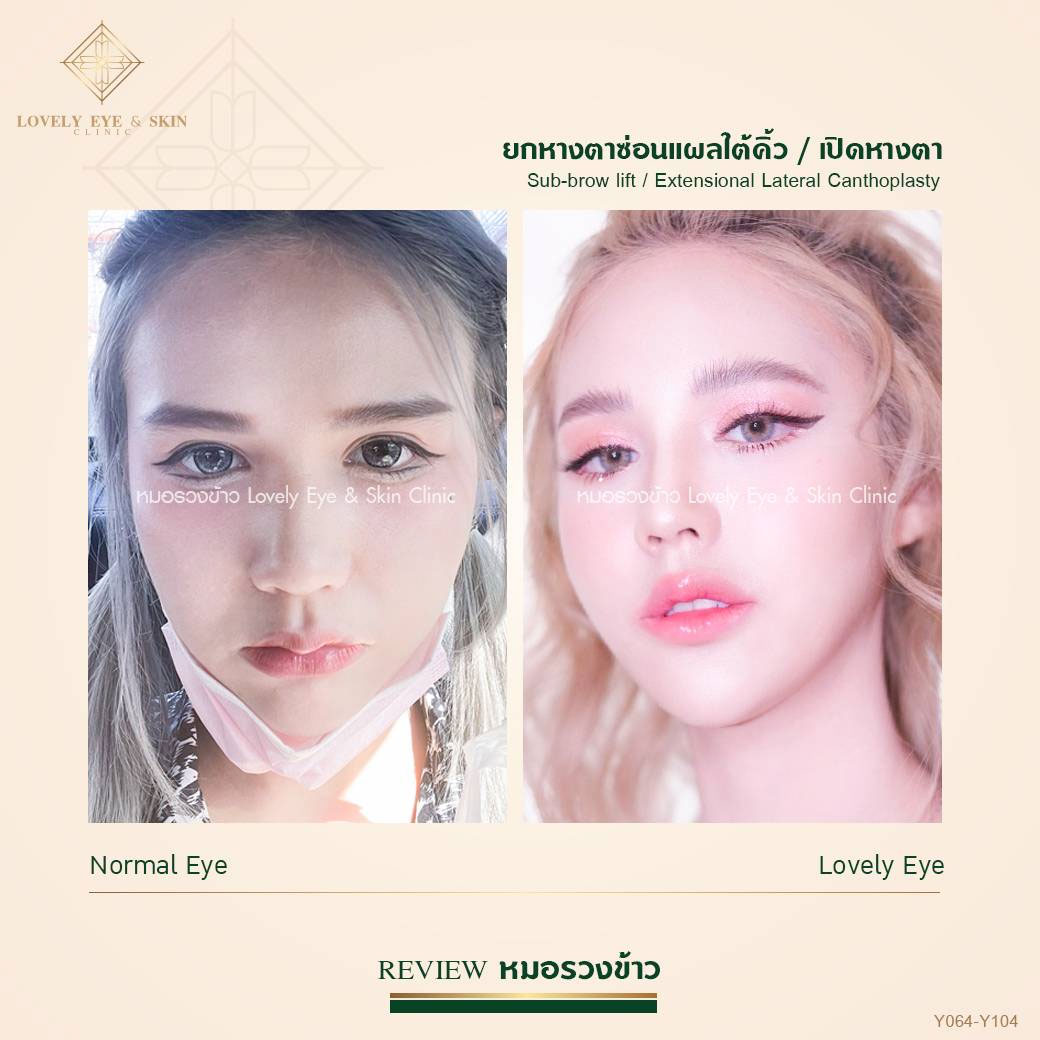 รีวิวทำตา Foxy Eyes